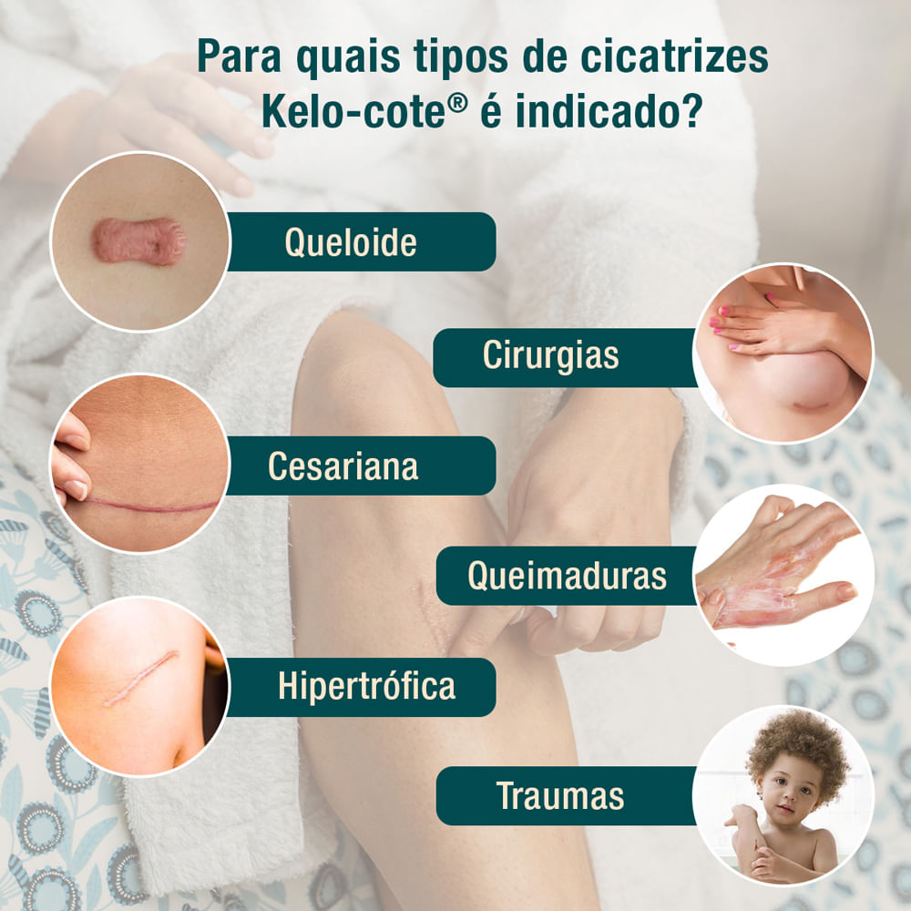 Kelo-Cote Gel Redutor de Cicatrizes - 15g - Imagem 4